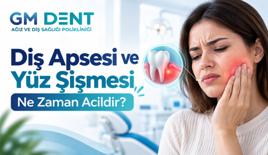 Diş Apsesi ve Yüz Şişmesi: Arnavutköy’de Acil Dişçiye Ne Zaman Gidilmeli?