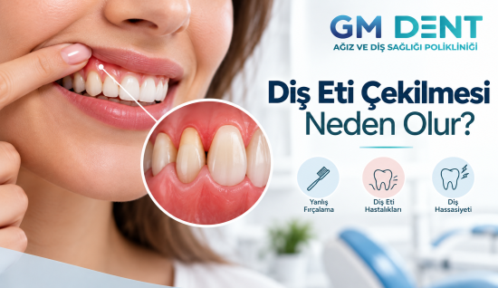 Diş Eti Çekilmesi Neden Olur? Belirtileri ve Tedavisi
