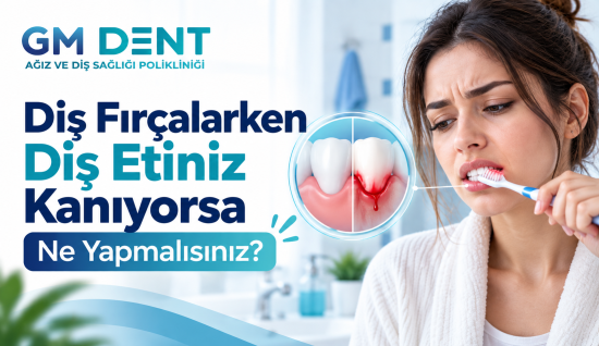 Diş Fırçalarken Diş Etiniz Kanıyorsa Ne Yapmalısınız?