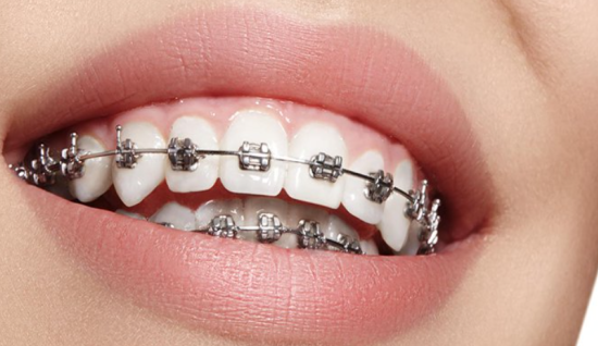 Dişlerin Geometrisi: Arnavutköy’ün Sokaklarından Diş Dizilimine Estetik Bir Yolculuk