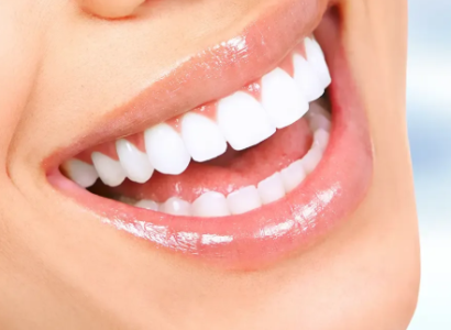 Estetik Gülüş Tasarımı (Hollywood Smile)