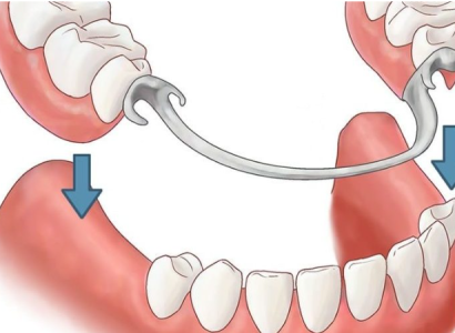Protetik Diş Tedavisi (Protez ve Kaplama Uzmanlığı)